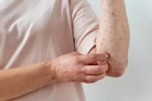 Uma pessoa com coceira